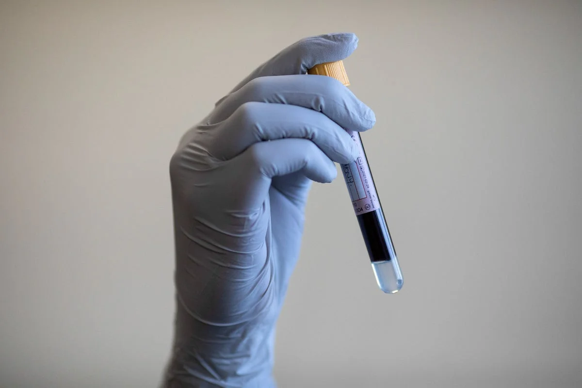 Blood Test Offers Alternative to Invasive Gynaecological Procedures for Cancer Detection