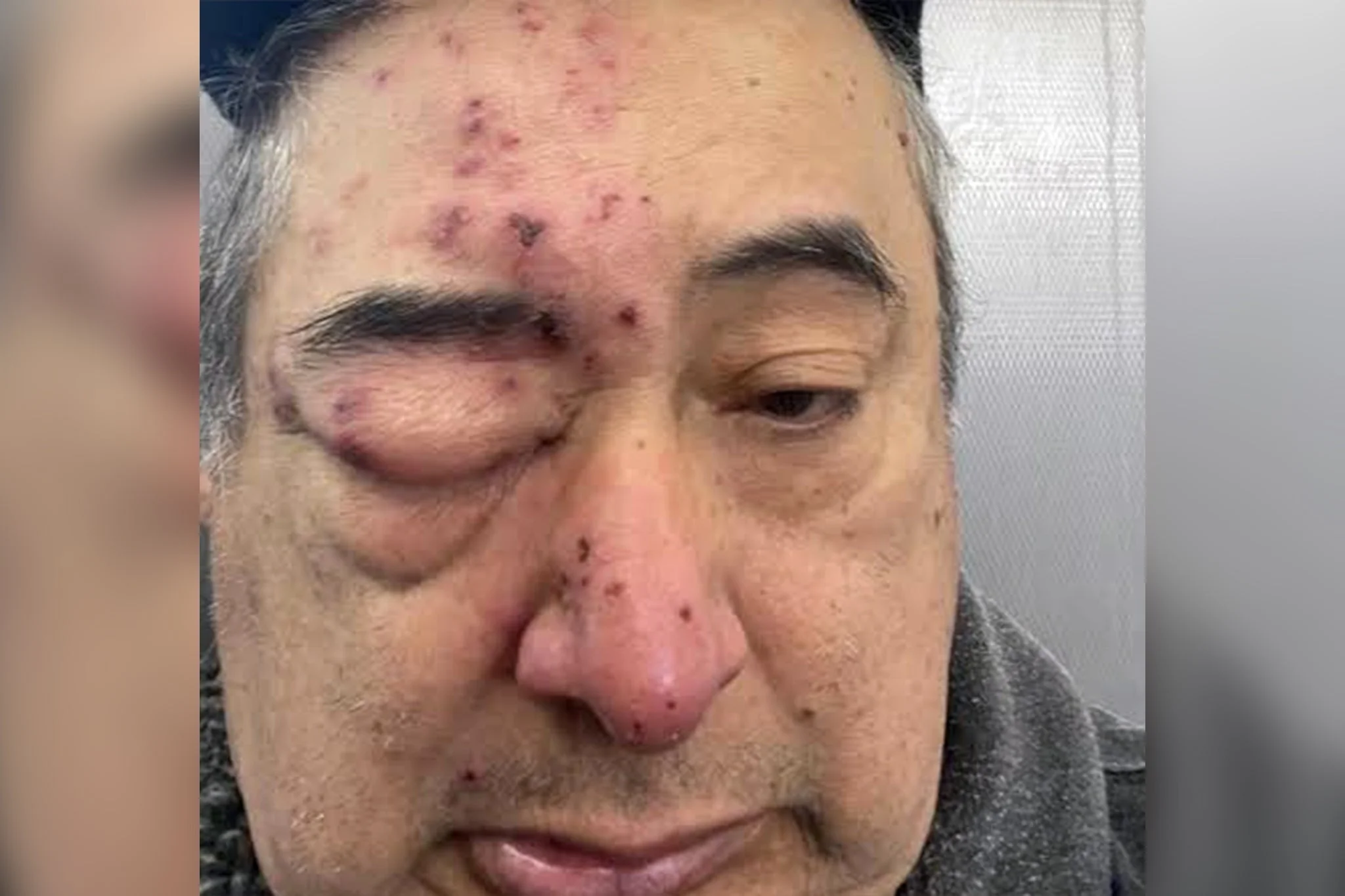 Herivierto Hernandez said he woke up with rats on his face